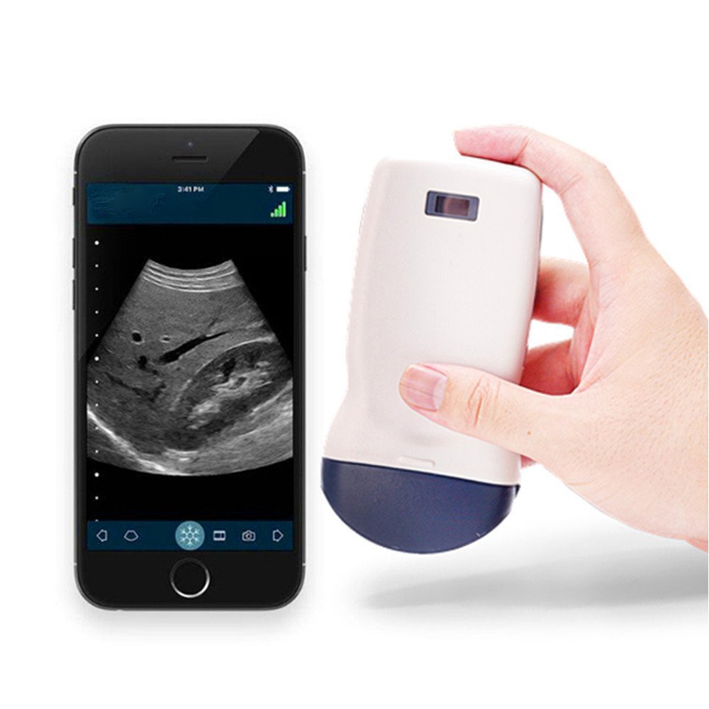 Veterinary Wireless Ultrasound Scanner Vet-W1 Veterinary wireless handheld ultrasound