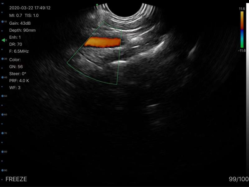 Wireless Transvaginal Ultrasound Scanner TRC result