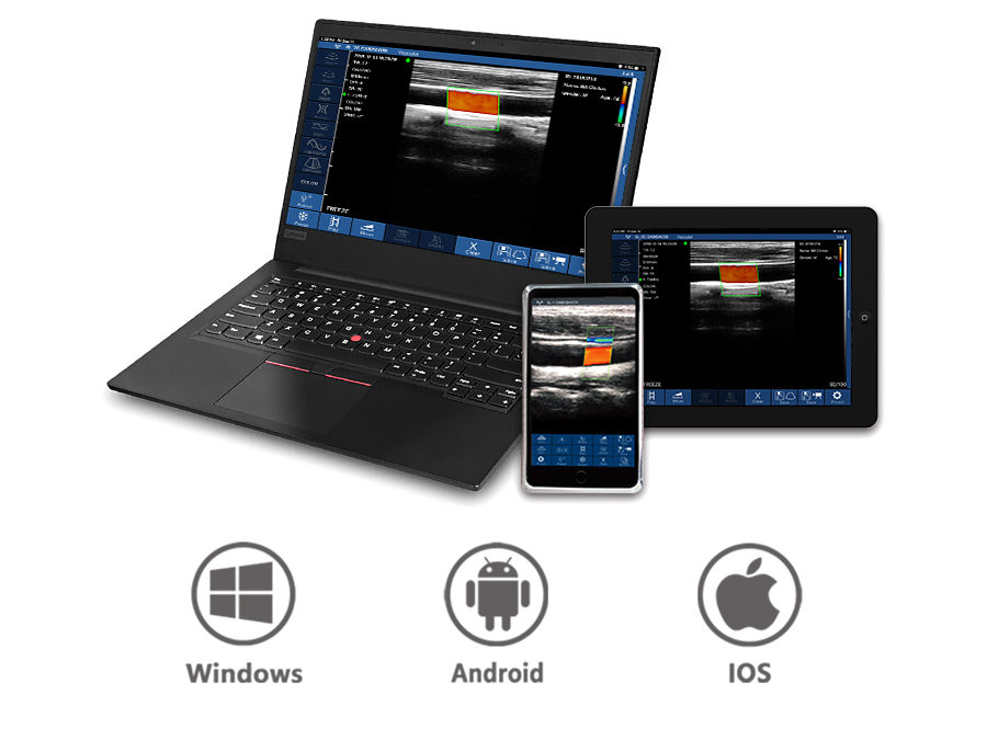 3in1-CLC3CD Wireless 3 in 1 Ultrasound Scanner