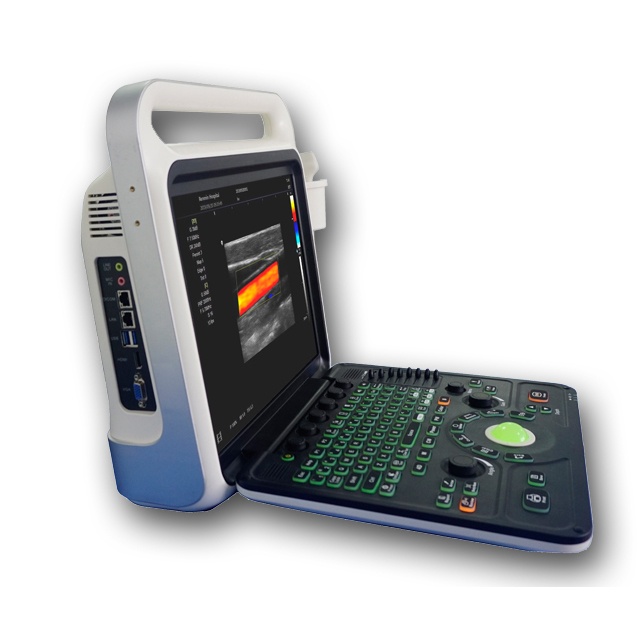 Color Doppler Convex Diagnostic Ultrasound Scanner