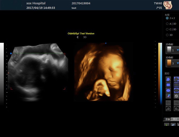 Scan-Results-of-Color-Doppler-Convex-Diagnostic-Ultrasound-Scanner-