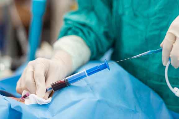 Vascular-Surgeon-In-Operation