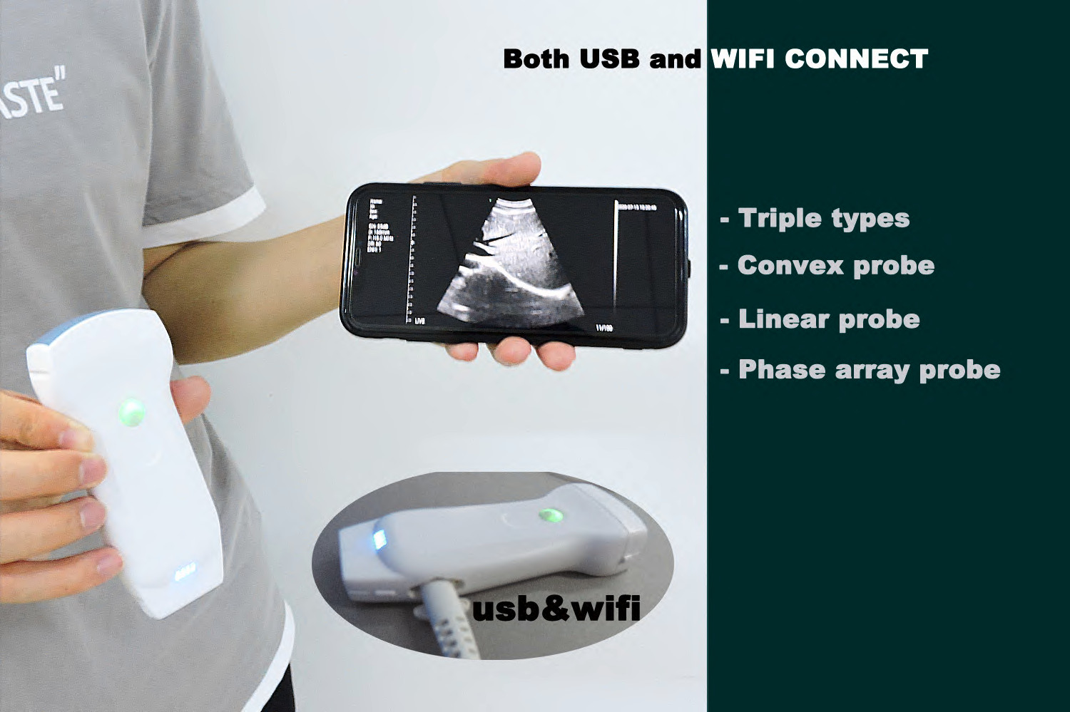 Wireless and USB 3 in 1 Ultrasound