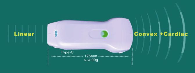 USB and Wireless ultrasound 3in 1 probe