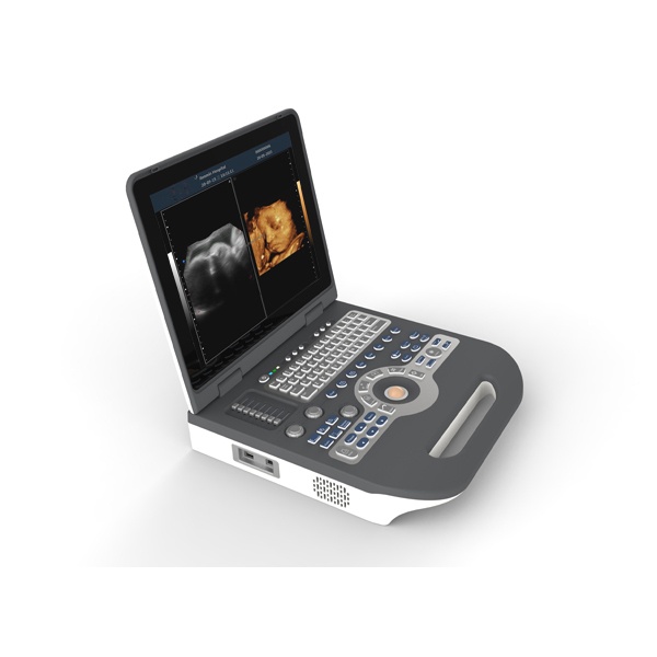 Color Doppler Notebook Ultrasound Scanner