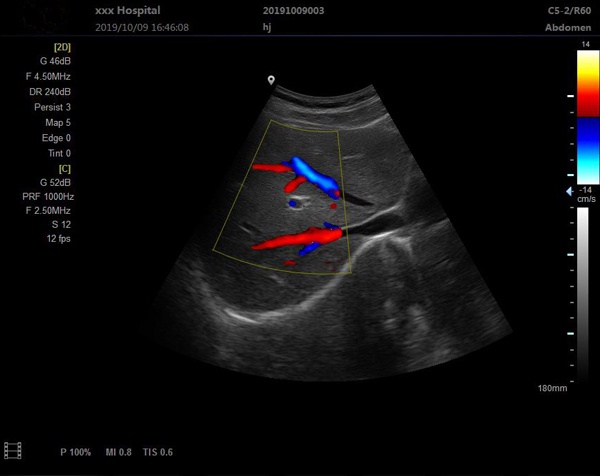 Scan-Results-of-Notebook-Color-Doppler-Ultrasound-Scanner-