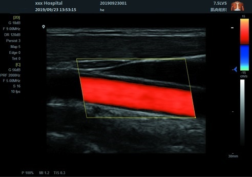 Scan-Results-of-Notebook-Color-Doppler-Ultrasound-Scanner